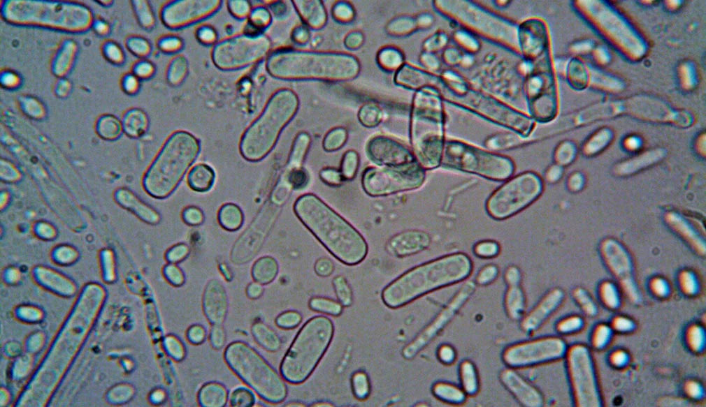 What is the difference between LIVE probiotics and Probiotic Extracts? probiotics?
