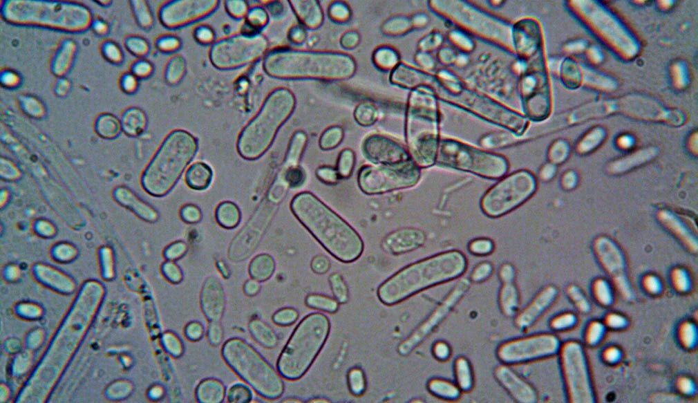 What is the difference between LIVE probiotics and Probiotic Extracts? probiotics? - LaFlore