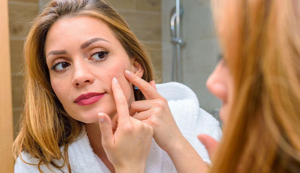 acne management with topical probiotics