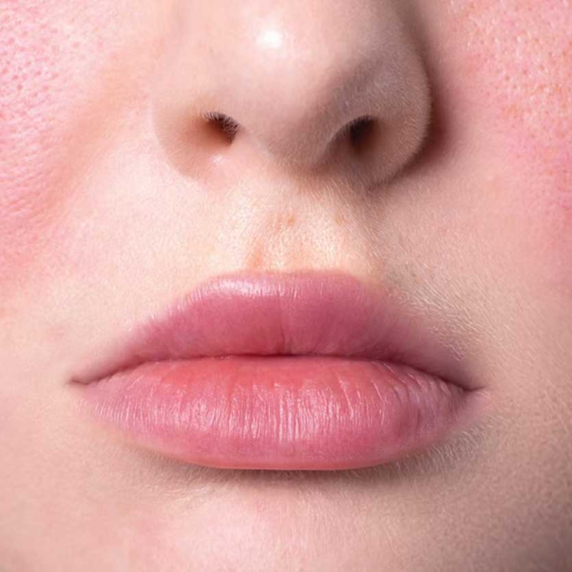 WellSpa 360: 5 Treatment Protocols to Soothe Sensitive Skin
